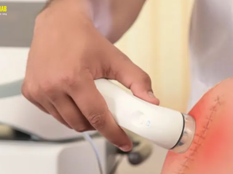 Tác nhân vật lý